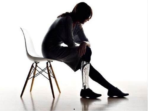 上臂假肢人生活视频,真实视频展现日常挑战与适应